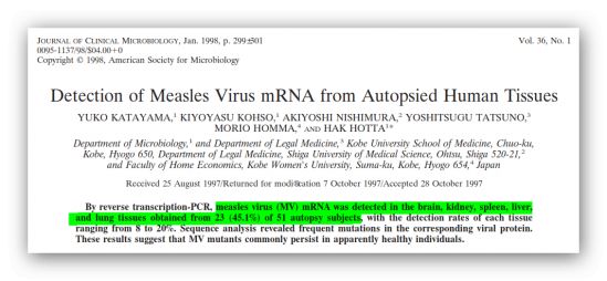 Presenza del virus del morbillo nel cervello ed in altri tessuti umani autoptici