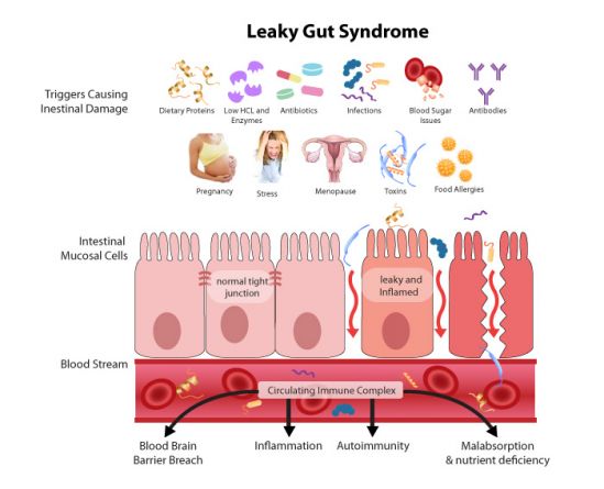 Permeabilità intestinale alterata nell&#039;autismo