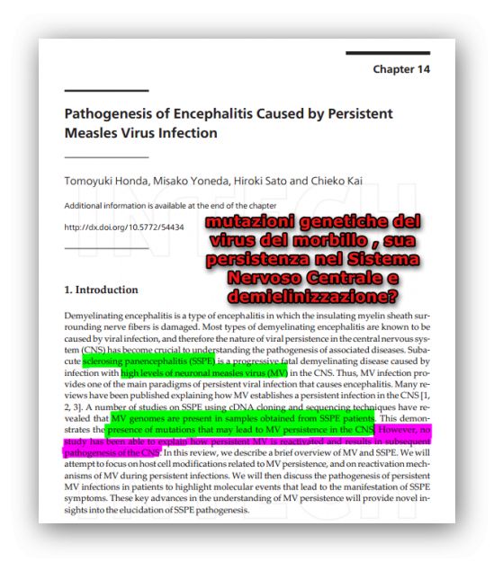 Virus del Morbillo ed Anticorpi contro la proteina basica della mielina ( MBP )