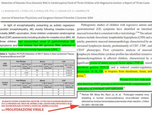 Proliferazione del virus del morbillo vaccinale: 3 casi clinici autistici